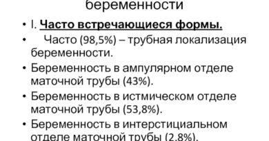 Внематочная беременность и ее классификации. Смотреть фото Внематочная беременность и ее классификации. Смотреть картинку Внематочная беременность и ее классификации. Картинка про Внематочная беременность и ее классификации. Фото Внематочная беременность и ее классификации